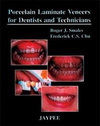 Porcelain Laminate Veneers For Dentists And Technicians 1/e