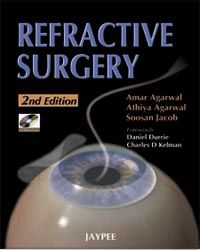 Refractive Surgery 1/e