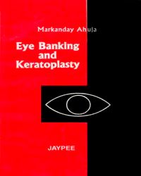 Eye Banking And Keratoplasty 1/e