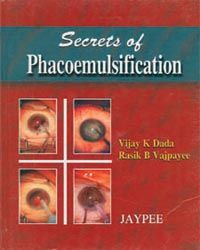 Secrets Of Phacoemulsification  2001