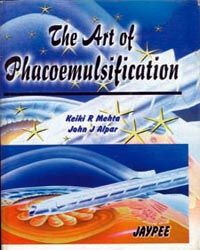 The Art of Phacoemulsification 01 Edition 