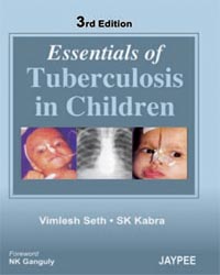 Ess. Of Tuberculosis In Children 3/e