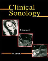 Clinical Sonology  1/e