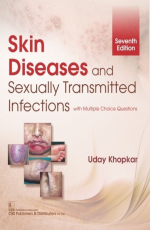 SKIN DISEASES AND SEXUALLY TRANSMITTED INFECTIONS (PB 2019)