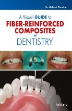 A Visual Guide to Fiber-Reinforced Composites in Dentistry