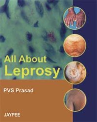 All About Leprosy, 2nd Ed