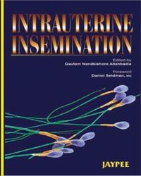 Intrauterine Insemination, 2005