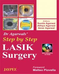 Step By Step lasik Surgery with CD ROM, 2005