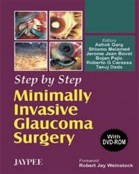 Step By Step Minimally Invasive Glaucoma Surgery With Dvd- Rom