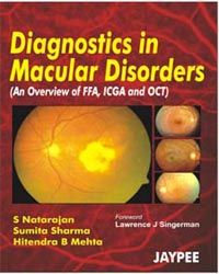 Diagnostics in Macular Disorders 1st Edition 