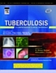 Tuberculosis - A Comprehensive Clinical Reference 