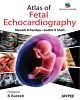 Atlas of Fetal Echocardiography With Interactive DVD-Rom 1/e Edition