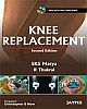 Knee Replacement (With Interactive DVD-Rom) 