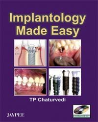 Implantology Made Easy (With DVD-ROM) 1st Edition