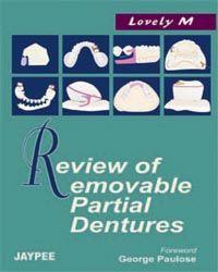 Review of Removable Partial Dentures 