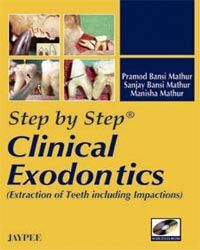 Step by Step Clinical Exodontia with DVD-ROM