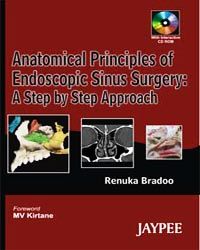  Anatomical (R) Principles Of Endoscopic Sinus Surgery:A Step By Step Approach With Interactive Cd- Rome 1/e Edition