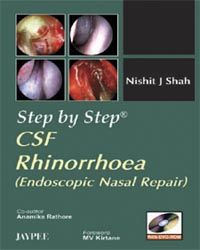 Step by Step CSF Rhinorrhoea: Endoscopic Nasal Repair