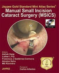 Jaypee Gold Standard Mini Atlas Series Manual Small Incision Cataract Surgery (MSICS) with DVD-ROM 