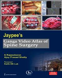 Jaypee`s Ganga Video Atlas of Spine Surgery