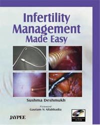 Infertility Management Made Easy with CD-ROM