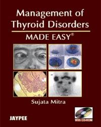 Management of Thyroid Disorders Made Easy with CD-ROM