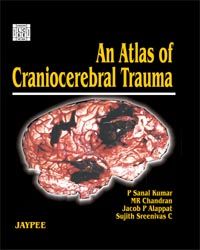 An Atlas of Craniocerebral Trauma