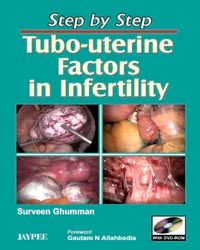 Step by Step Tubo-uterine Factors in infertility with DVD-ROM 1st Edition