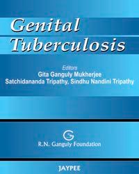 Genital Tuberculosis