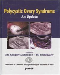 Polycystic Ovary Syndrome An Update 01 Edition