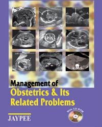 Management of Obstetrics and its Related Problem with CD-ROM 1st Edition