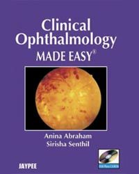 Clinical Ophthalmology Made Easy with Photo CD-ROM