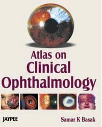 Atlas on Clinical Ophthalmology (Complete Book Available in PDF Format)