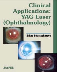 Clinical Application YAG Laser (Ophthalmology)