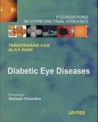 Diabetic Eye Diseases Foundations in Vitreoretinal Diseases 1st Edition 