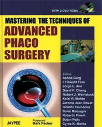 Mastering the Techniques of Advanced Phaco Surgery with 2 DVD-ROMs 1st Edition 