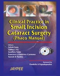 Clinical Practice in Small incision Catract Surgery(Phaco Manual) with 2 CD-ROMs 1st Edition 