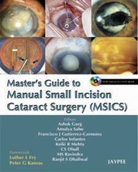 MASTERS GUIDE TO MANUAL SMALL INCISION CATARACT SURGERY ( MSICS) 