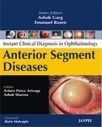 Instant Clinical Diagnosis in Ophthalmology: Anterior Segment Lens Diseases 