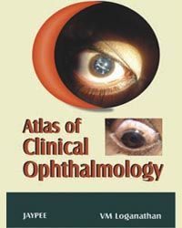 	 Atlas of Clinical Ophthalmology 