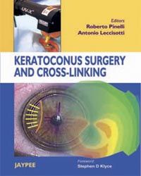 Keratoconus Surgery and Cross-Linking 