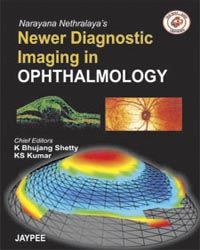 Narayana Nethralaya`s Newer Diagnostic Imaging in Ophthalmology 