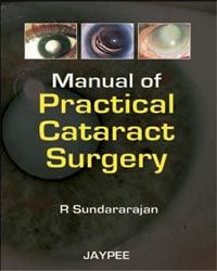 Manual of Practical Cataract Surgery 