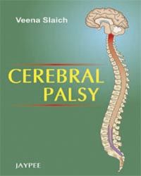 Cerebral Palsy