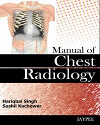 Manual of Chest and Radiology