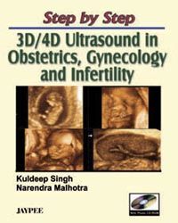 Step by Step 3D/4D in Ultrasound in Obstetrics,Gynecology and infertility with Photo CD-ROM