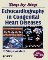 Step by Step Echocardiography in Congenital Heart Diseases with DVD-ROM 