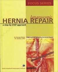 Laparoscopic Hernia Repair: A Step by Step Approach with CD-ROM