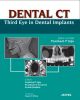 Dental CT: Third Eye in Dental Implants 