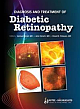 DIAGNOSIS AND TREATMENT OF DIABETIC RETINOPATHY,2010 